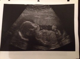 slide_335876_3385791_free